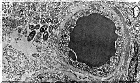 Brain microbiome: bacteria in the brain